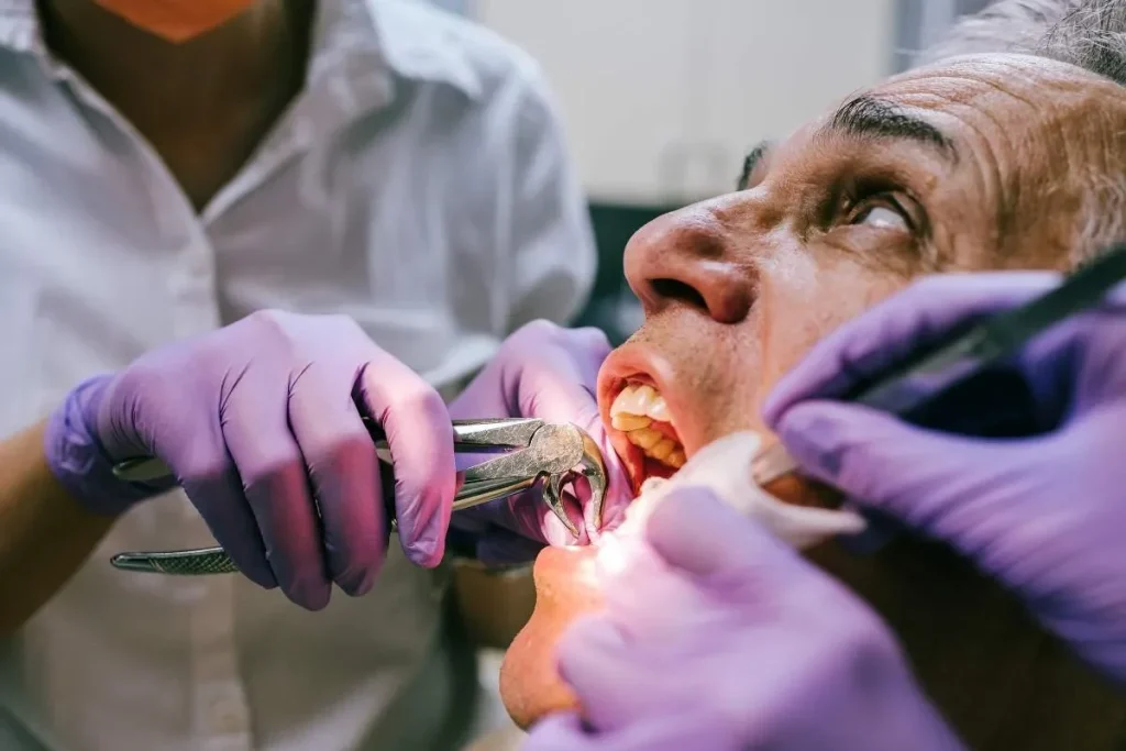 Combien de temps cicatrisation après extraction dentaire ?